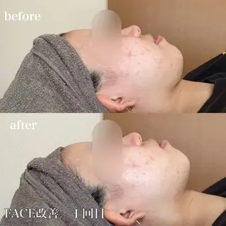 磐田｜LAYLA 一番丁寧な脱毛店のエステ・リラクイメージ