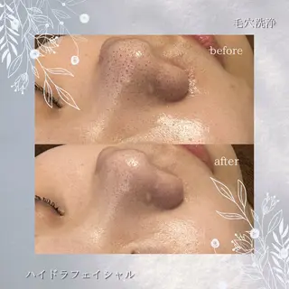 ENCHANT Kaede/肌質改善のその他イメージ