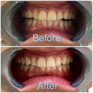 イーチブライト EachBrightのその他イメージ