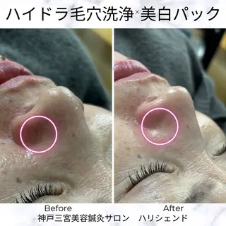 美容鍼・小顔矯正 ハリシェンドのエステ・リラクイメージ