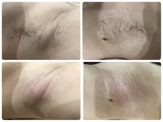 産後/ツヤ肌/子連れ /保育士在籍サロンのエステ・リラクイメージ