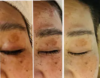 シミ・たるみ・毛穴ケア専門サロン Alluring所属・Alluring 中村のエステ・リラクイメージ