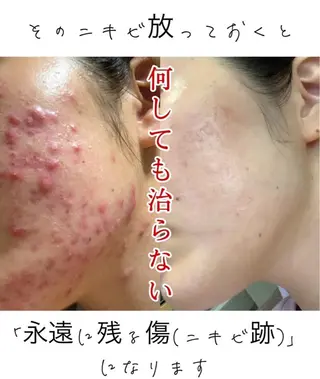 M渋谷店所属・Ｍ渋谷 ホワイトニングのエステ・リラクイメージ