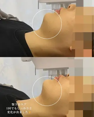 看護師が施術する ナスサロ/Emi🪽のエステ・リラクイメージ