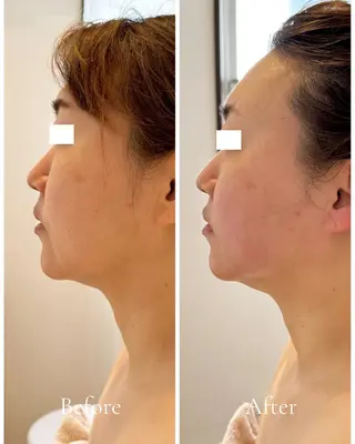 Lani Moon所属・⟡ 京都 小顔  ⊹ Lani Moonのエステ・リラクイメージ