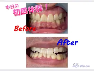 セルフホワイトニングサロン　ラヴィアン所属・ホワイトニングサロン La vie enのその他イメージ