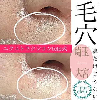 private salon  Dea_maris シュガーリング＆パーソナルボディケア所属・シミ改善・韓国肌管理 ボディメイク痩身のその他イメージ