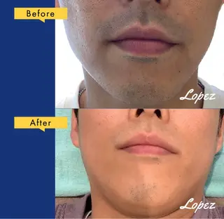 メンズ メンズ脱毛エステサロンロペス所属・小池 里穂のエステ・リラクイメージ