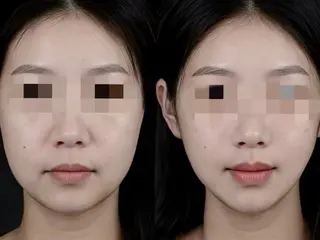 aliaハイフ&水光ジェットサロン所属・aliaハーブ水光店 エステティシャン募集のエステ・リラクイメージ