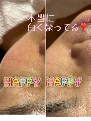 うえつま ふみえのエステ・リラクイメージ