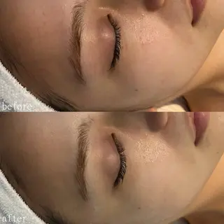 デ・アイム心斎橋所属・肌質改善サロン🫧 MAIのエステ・リラクイメージ