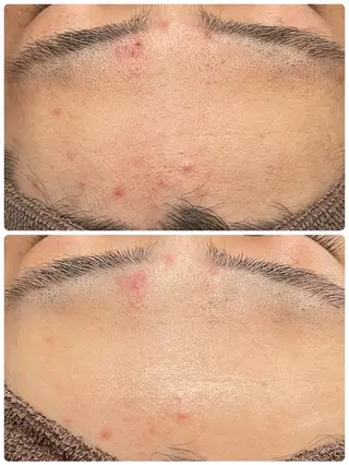 TLIENGLE高宮 エステ・ネイルのエステ・リラクイメージ