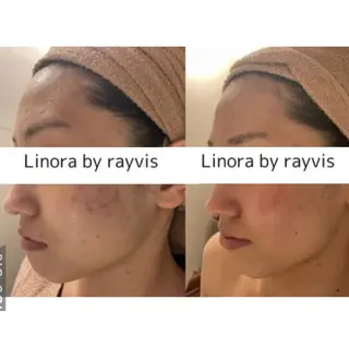 👑Linolaby RAYVIS👑⭐️のエステ・リラクイメージ