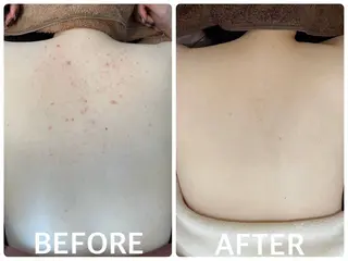 ハーブピーリング 🌿京橋のエステ・リラクイメージ