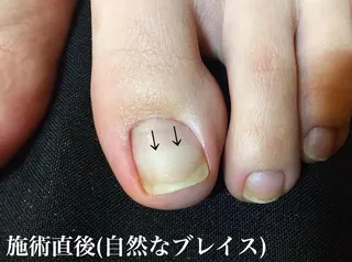 ネイル Viseo《6週間 長持ちパラジェル》のネイルデザイン