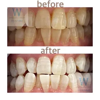 ホワイトニング ショップ本八幡店のエステ・リラクイメージ