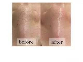 salon de coco所属・毛穴、肌質ケア専門 グランビューティのエステ・リラクイメージ