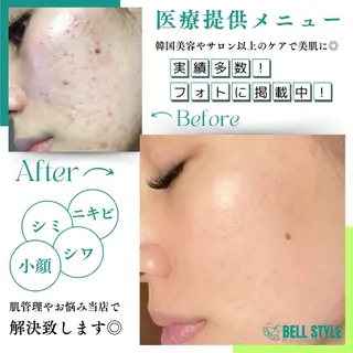 メンズ メンズ&レディース　Bell style所属・【脱毛・美肌専門】 bellstyleのエステ・リラクイメージ