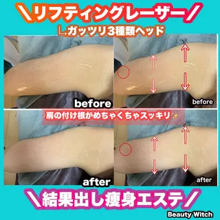 痩身/脱毛/ネイル HARUKAのエステ・リラクイメージ