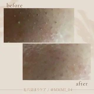 デ・アイム新潟北所属・サイトウ .のエステ・リラクイメージ