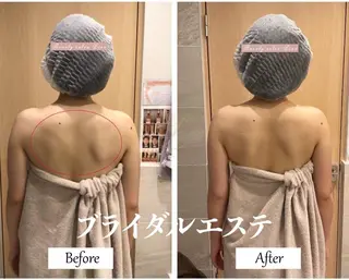 ブライダルサロン ｜Lino【堀江】のエステ・リラクイメージ