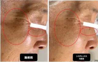 ヴィーナス ビューティーのエステ・リラクイメージ