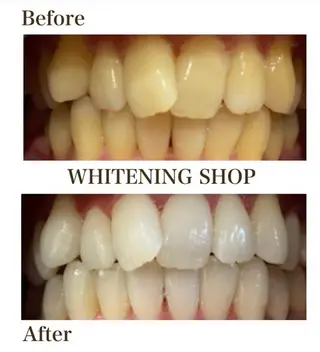 ホワイトニングショップ津店所属・ホワイトニング ショップ津店のその他イメージ