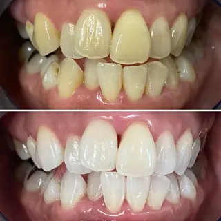 ホワイトニング ⚓︎CREW柏⚓︎のその他イメージ