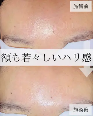 毛穴汚れ改善専門店/ 岸和田/リヒオルオルのエステ・リラクイメージ