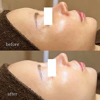 韓国肌管理・肌質改善 EARNEST心斎橋のエステ・リラクイメージ