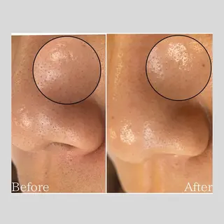 韓国肌管理 【毛穴専科】のエステ・リラクイメージ