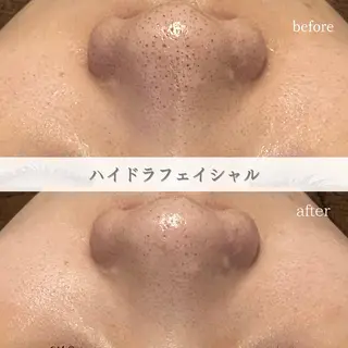 ENCHANT Kaede/肌質改善のその他イメージ