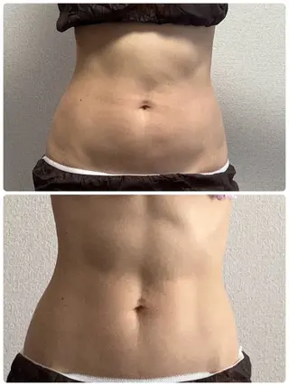 First Star所属・First Star あきの眉毛・アイブロウイメージ