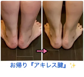 トータルビューティ/痩身・脱毛・オーラルケアホワイトニング Private salon Vi Vi所属・かとう 美惠子のその他イメージ