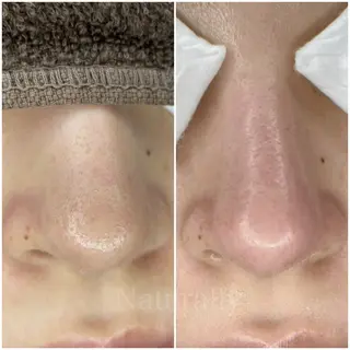 Naturally ナチュラリーのマツエク・マツパデザイン