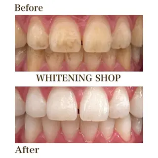 メンズ ホワイトニングショップ静岡葵区店所属・ホワイトニング ショップ葵区静岡駅店のその他イメージ