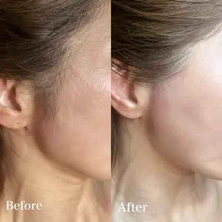 VIO /美肌専門サロン【Beauty  salon Bibiy】所属・VIO美肌専門サロン Bibiyのエステ・リラクイメージ