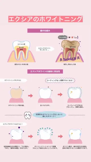 ecxia  white 　広島袋町店所属・セルフホワイトニング エクシア広島袋町店のその他イメージ