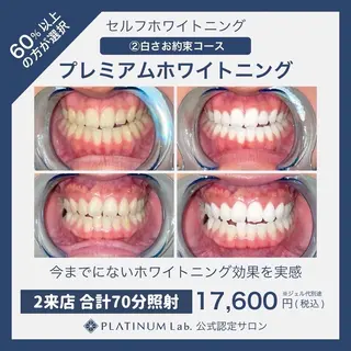 ホワイトニング専門店 PLATINUM Beauty 川崎店所属・PLATINUM Beauty 川崎店のその他イメージ