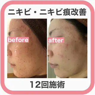 ミディアム カラー パーマ ヘアアレンジ メンズ キッズ ネイル マツエク・マツパ ニキビ・肌質改善専門 ♡人生が変わるサロンのエステ・リラクイメージ