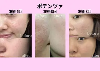 マツエク・マツパ aliaハイフ&水光ジェットサロン所属・aliaハーブ水光店 エステティシャン募集のエステ・リラクイメージ