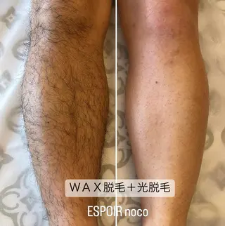 メンズ ワックス脱毛🌈 ESPOIRnocoのエステ・リラクイメージ
