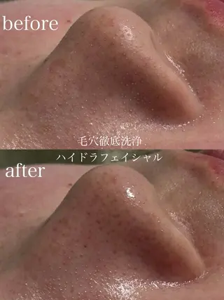 フェイシャルサロン CHIARA鈴木のエステ・リラクイメージ