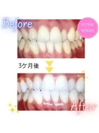 ecxia white 高田馬場所属・セルフホワイトニング エクシア 高田馬場のその他イメージ