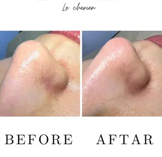 Le  cherien ル シェリア所属・毛穴洗浄/ハイフ サロンのエステ・リラクイメージ