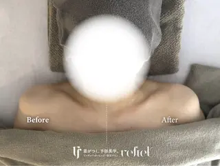 refiel たまプラーザ店所属・藤井 りさのエステ・リラクイメージ