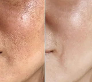 自爪育成ネイルサロン ココリュバンのネイルデザイン