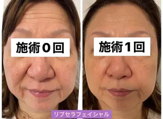 Private Salon Prunelle所属・プライベートサロン プリュネルのエステ・リラクイメージ