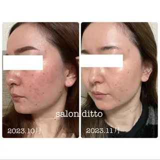 salon ditto所属・mio (小顔・ヘッドスパ)のエステ・リラクイメージ