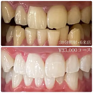 PLATINUM Beauty 横浜店所属・ホワイトニングルーム 横浜店のその他イメージ